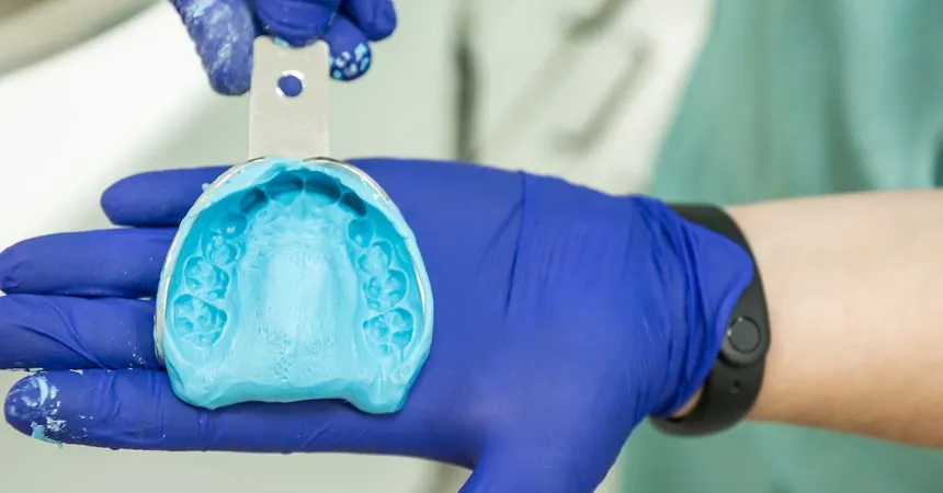 ¿Cuáles son los mejores materiales de impresión dental?